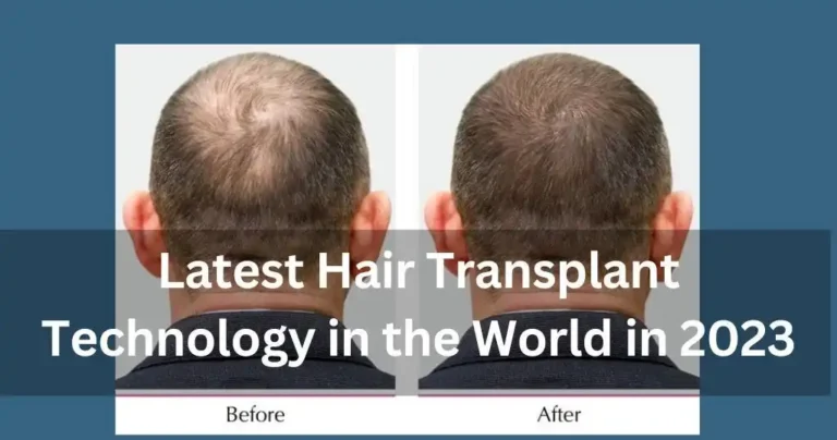 What is the Latest Technology in Hair Transplant?